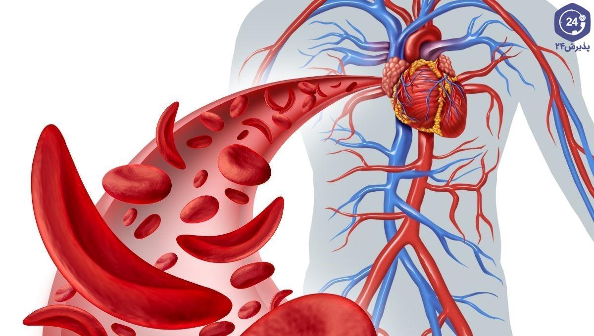 درمان فقر آهن