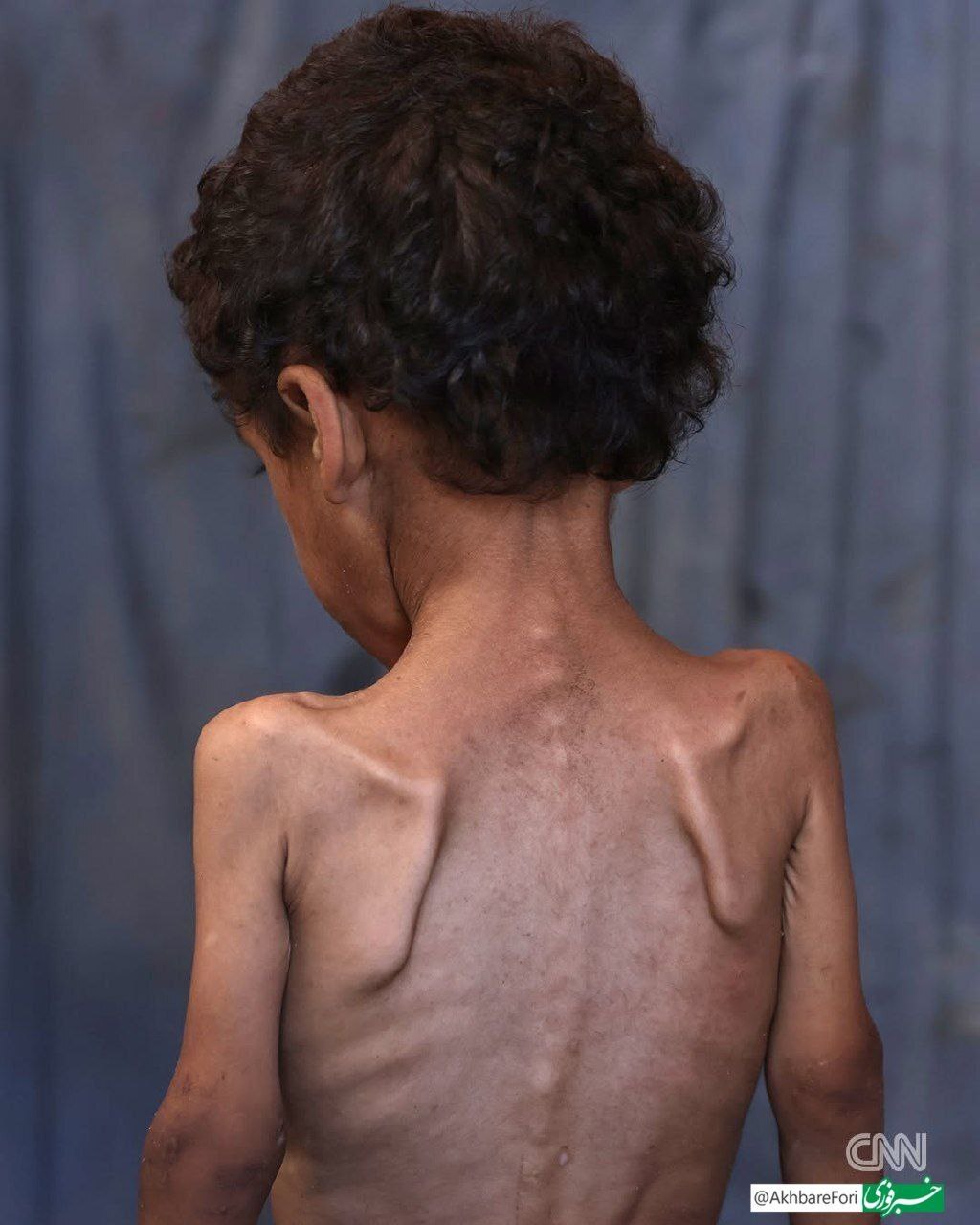 وضعیت دردناک انسانی در غزه