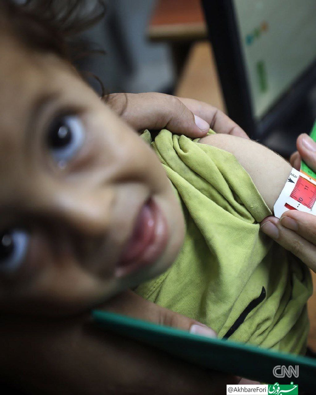 وضعیت دردناک انسانی در غزه