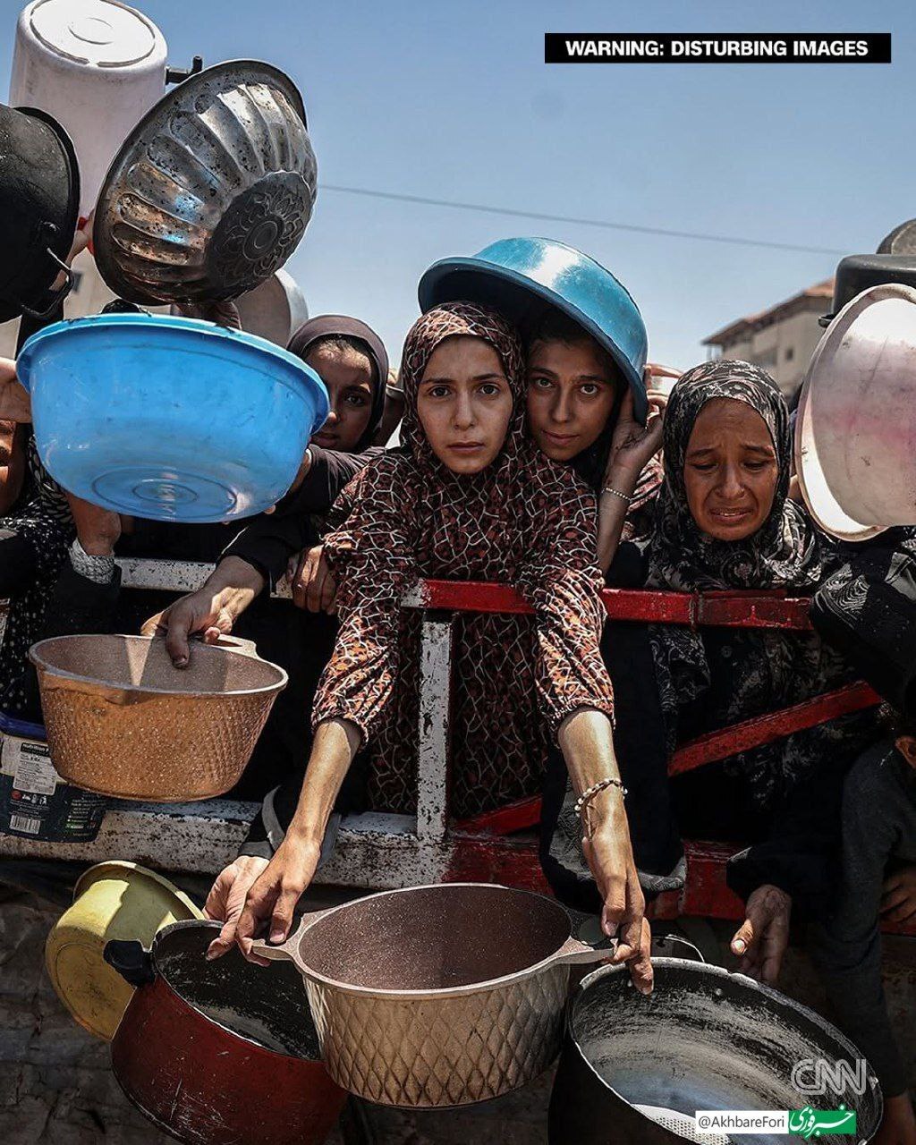 وضعیت دردناک انسانی در غزه