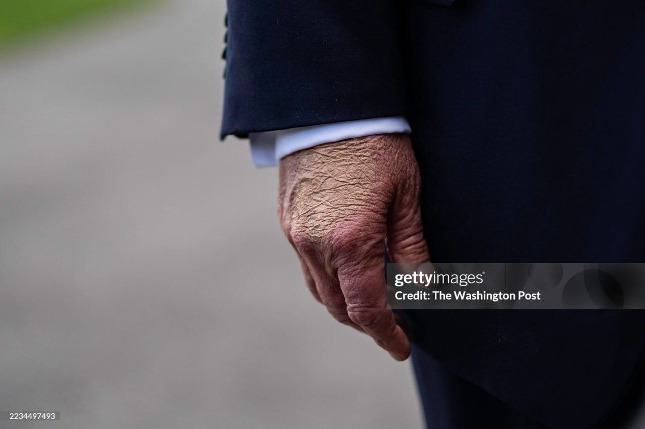 دستان ترامپ