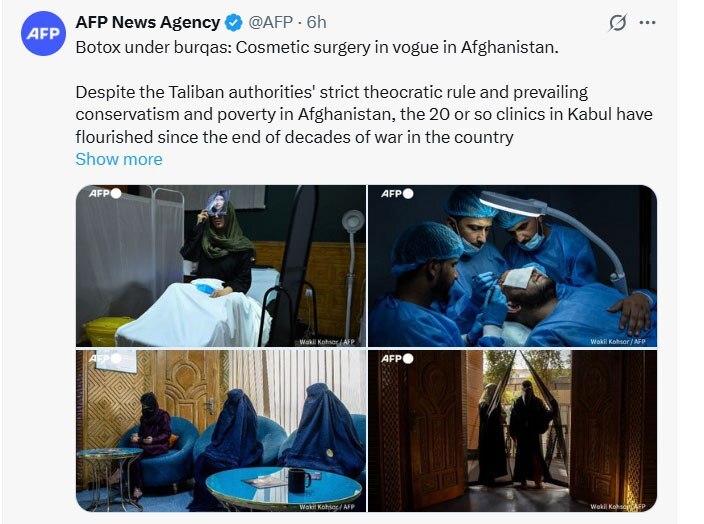 جراحی زیبایی در میان زنان افغان