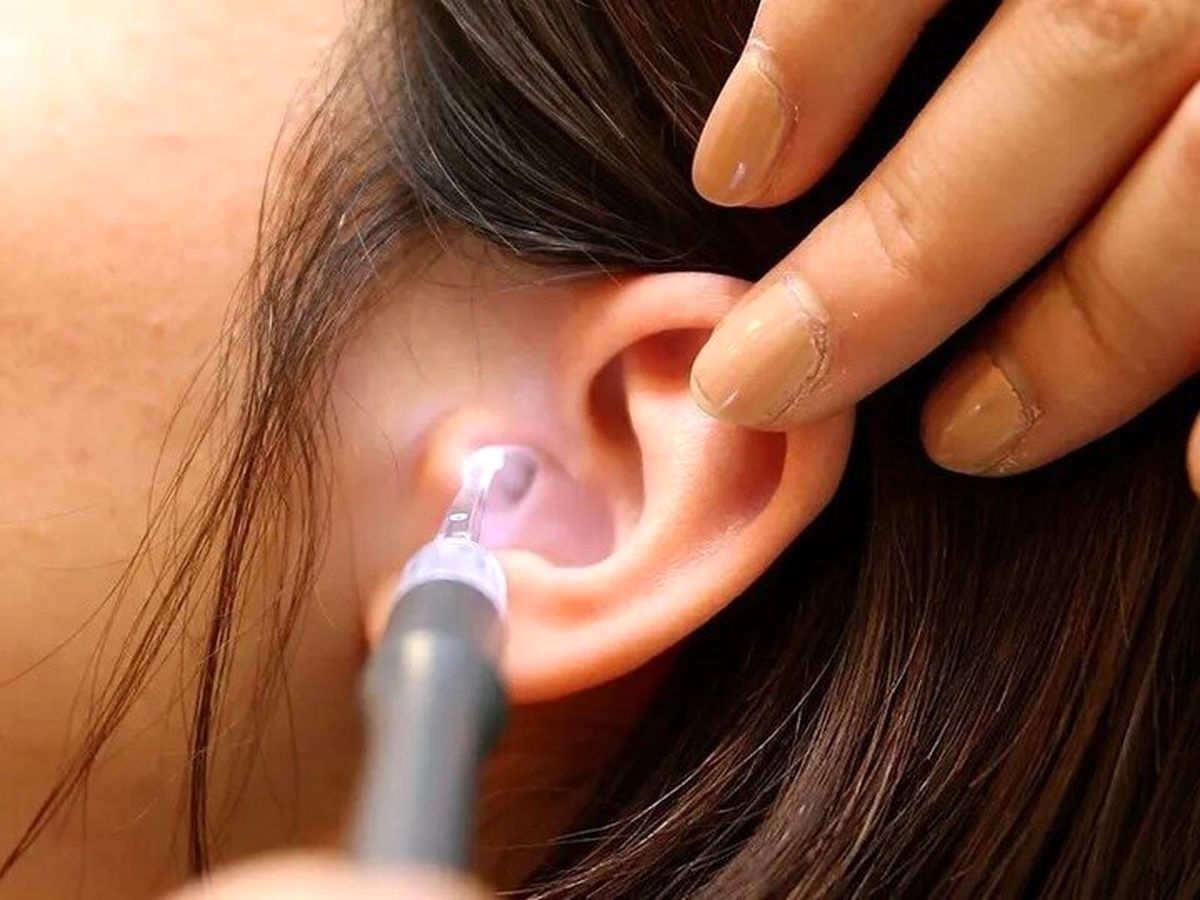 علائم سرطان لاله گوش را بشناسید علائم سرطان لاله گوش را بشناسید