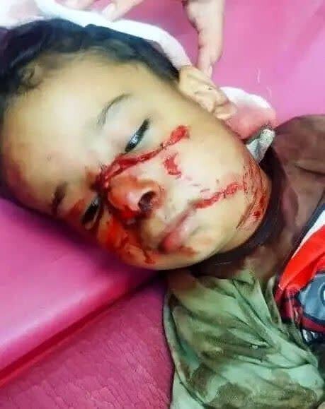 حمله سگ‌های ولگرد به کودک