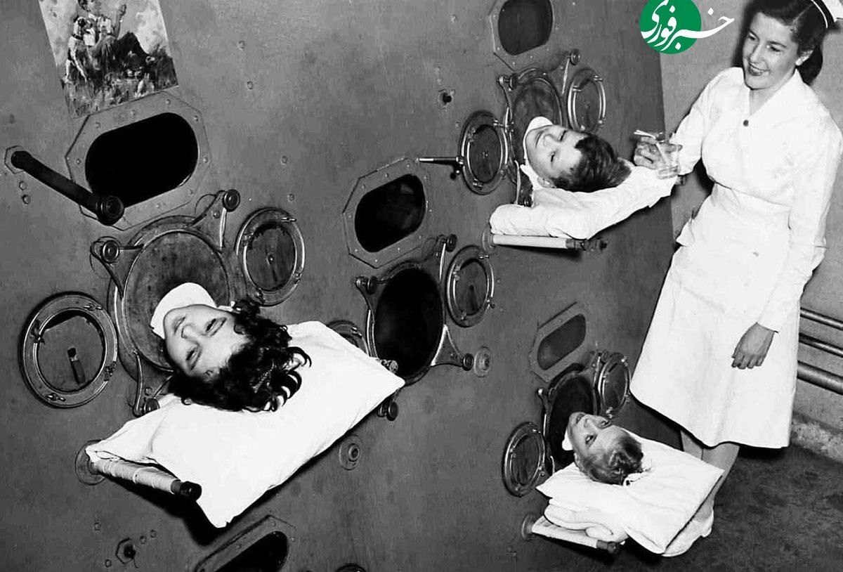 کودکان مبتلا به فلج اطفال