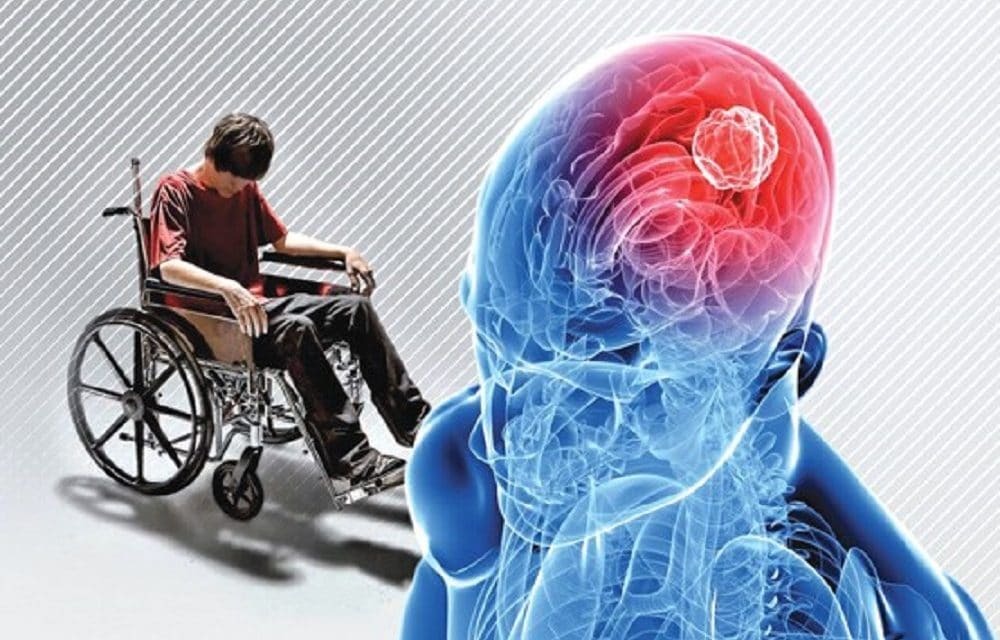 علائم‌ام اس را بشناسید/ کدام نشانه‌ها خطرناک است؟