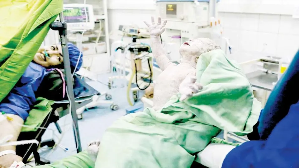 اتاق عمل زایمان