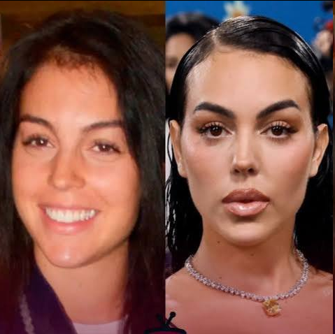 جورجینا رودریگز و تغییرات چهره‌اش از دید پزشکان