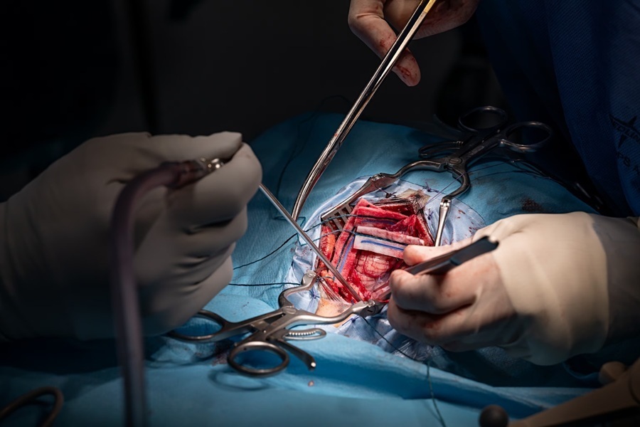 جراحی مغز | از تشخیص تا انتخاب بهترین جراح