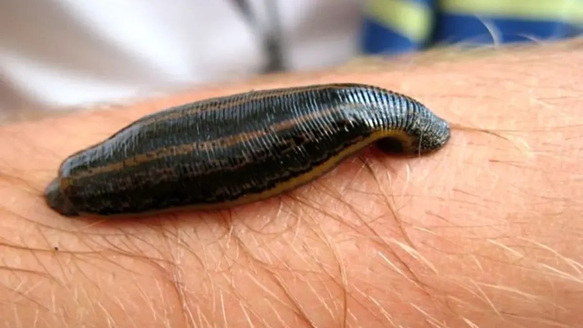 دیدن زالو در خواب دیدن زالو در خواب