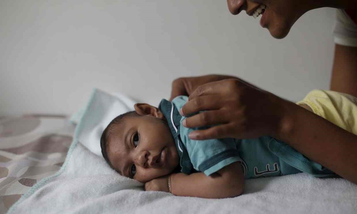 وضعیت طول عمر کودکان میکروسفالی وضعیت طول عمر کودکان میکروسفالی