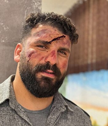 فیلم/ سقوط بلاگر مشهور ایرانی در کوهستان