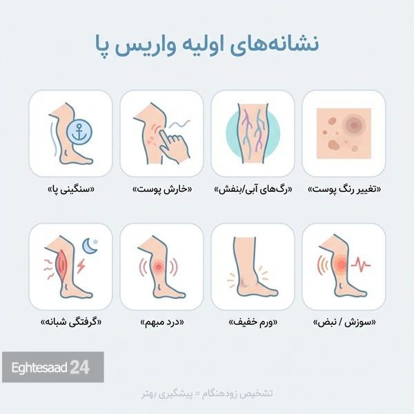 نشانه‌های اولیه واریس پا