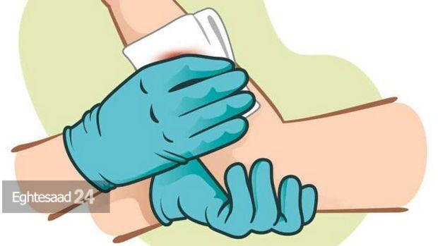 وسایل مورد نیاز برای کیت کنترل خونریزی