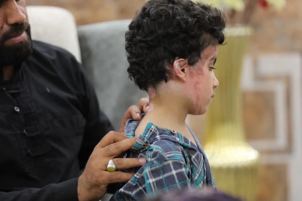 اولین تصاویر از کودک جانباز مدرسه میناب