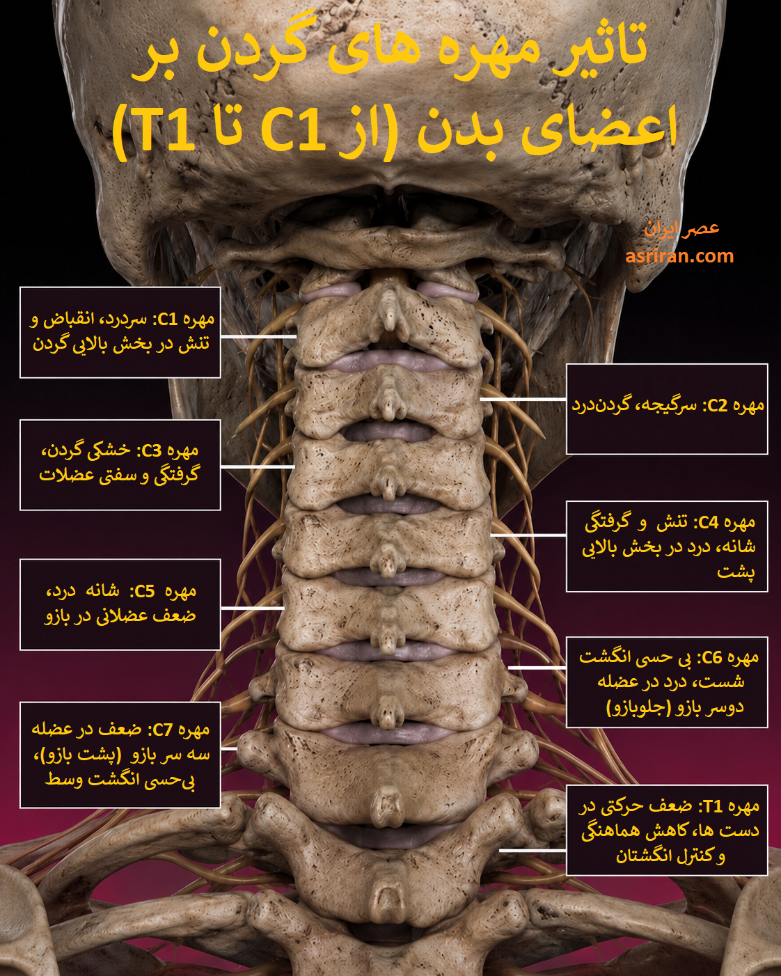 اینفوگرافی/مقصر اصلی درد، بی حسی و گزگز دست کجاست؟
