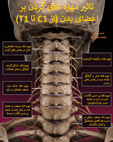 اینفوگرافی/مقصر اصلی درد، بی حسی و گزگز دست کجاست؟