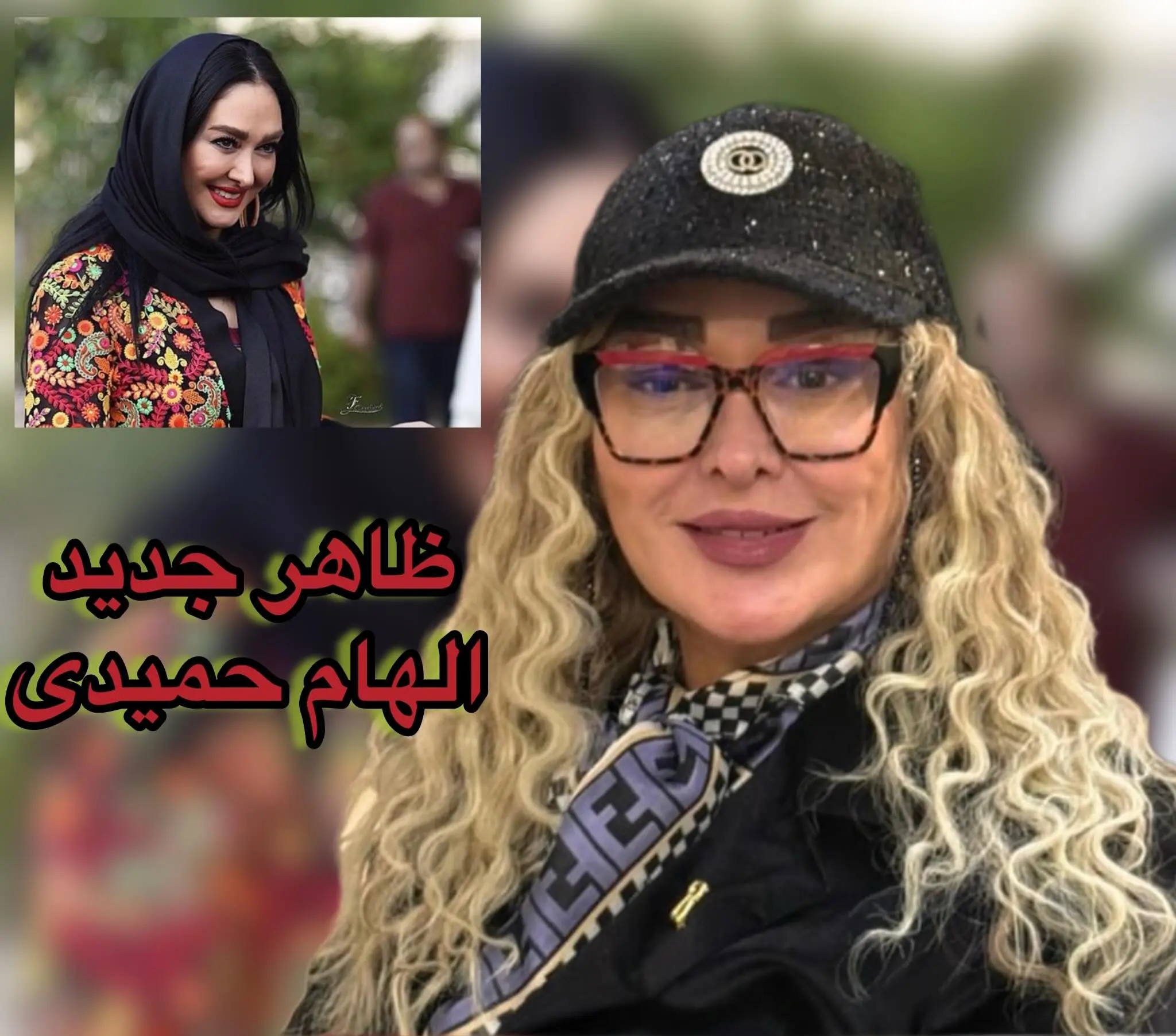 تغییر چهره الهام حمیدی