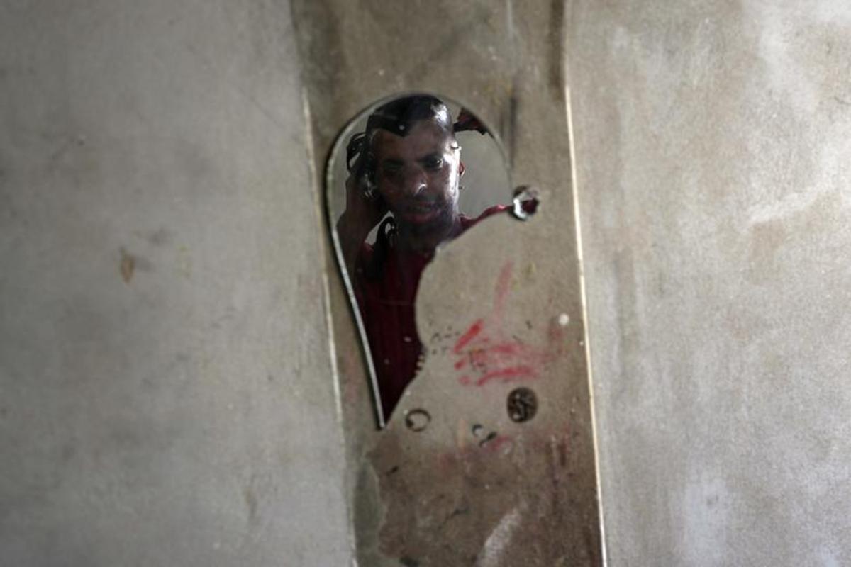 تهیه ماسک برای قربانیان سوختگی در غزه