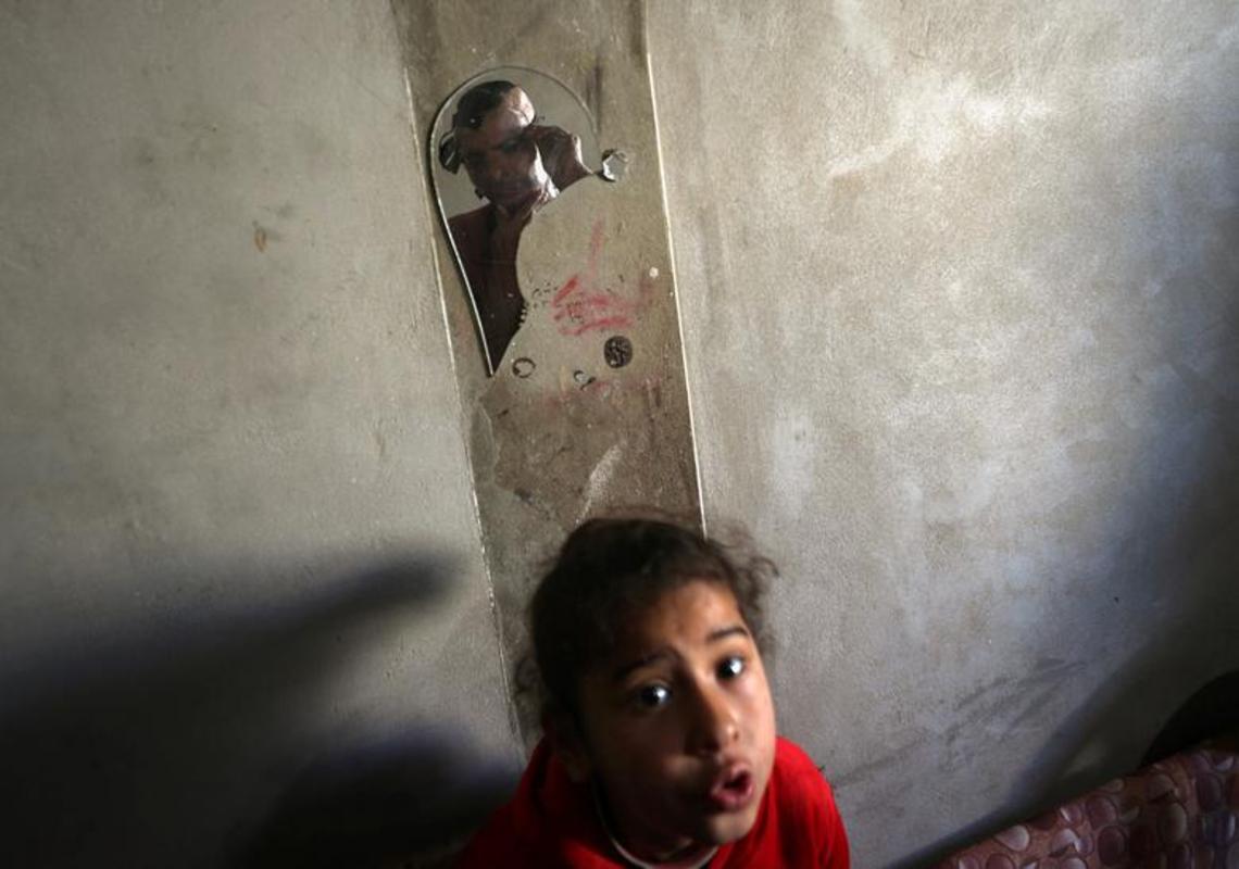 تهیه ماسک برای قربانیان سوختگی در غزه