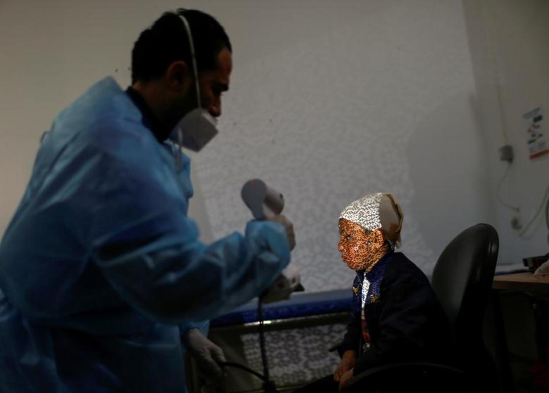 تهیه ماسک برای قربانیان سوختگی در غزه