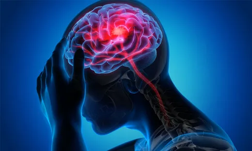 راه‌های مقابله با سکته مغزی