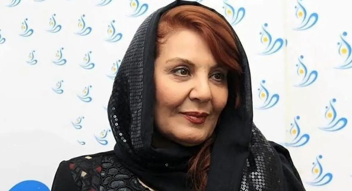 تغییر چهره خانم بازیگر مسن سوژه شد