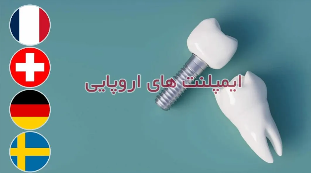 انواع ایمپلنت اروپایی