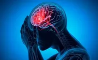 هشدار جدی وزارت بهداشت درباره سکته