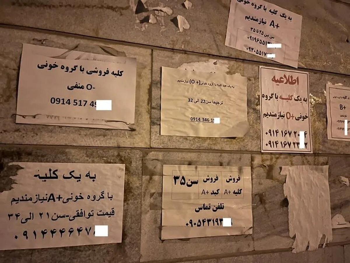 فروش دلاری کلیه ایرانی‌ها با سفر به ترکیه و عراق