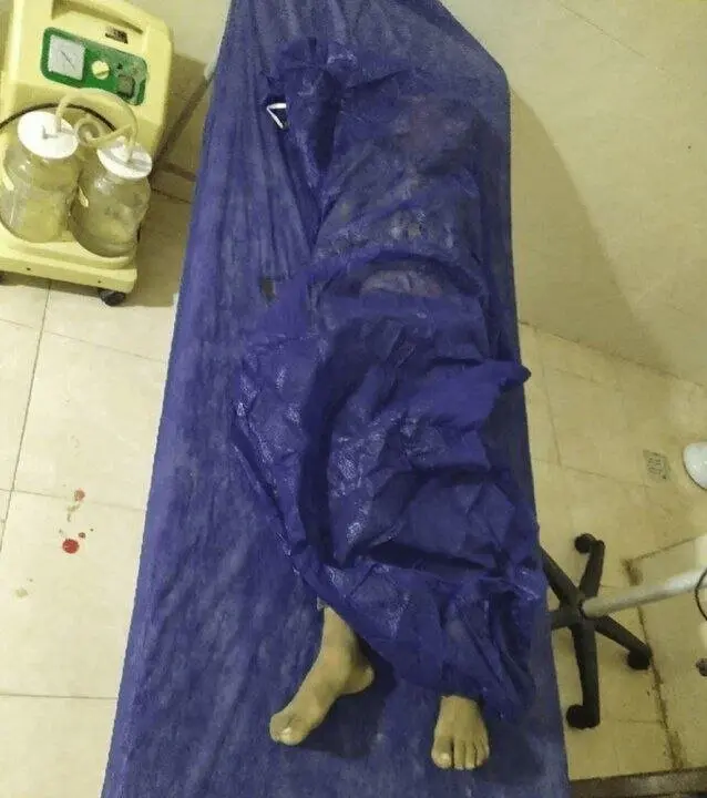 عکس پیکر کودک شهید حمله آمریکا به سیریک