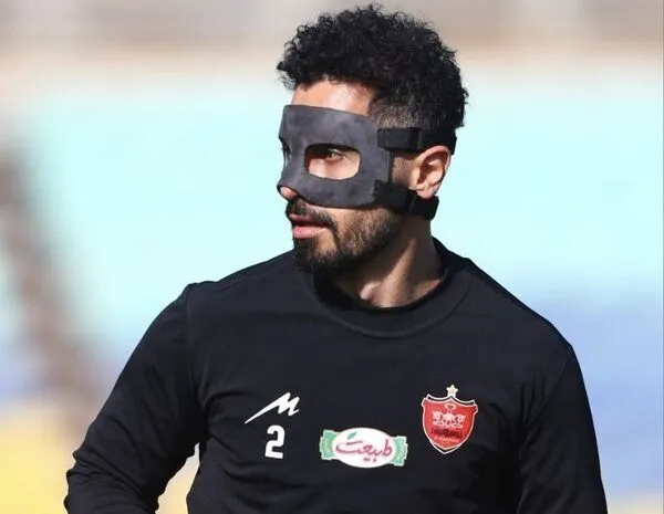 امید عالیشاه نقابش را برداشت
