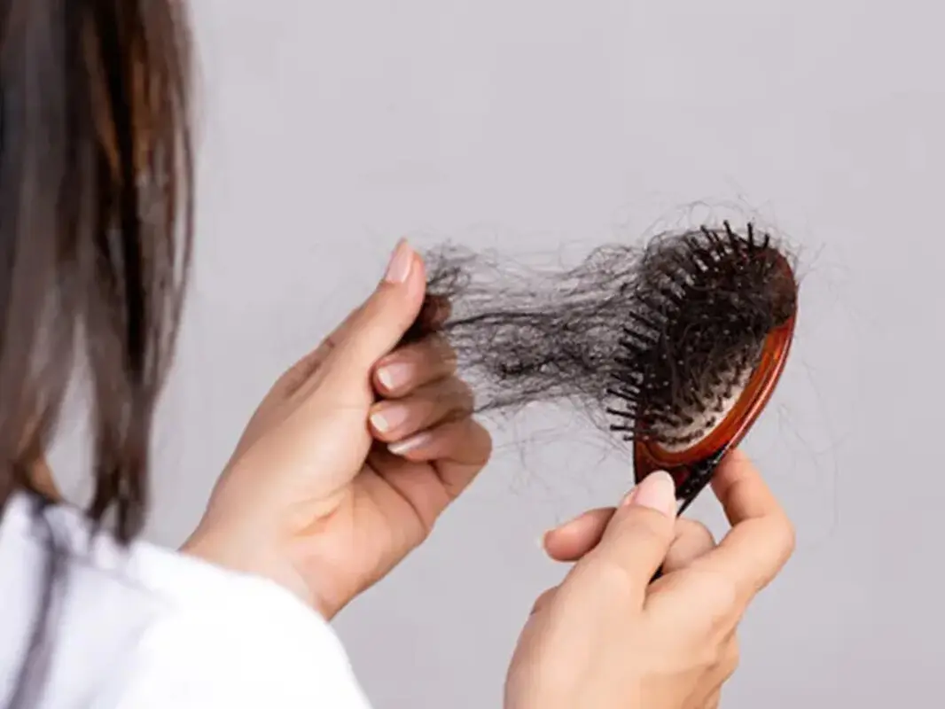 دلیل ریزش موی سر دلیل ریزش موی سر
