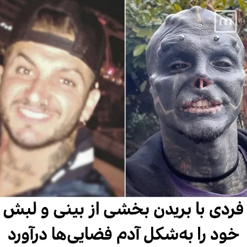 جراحی پلاستیک برای تبدیل شدن به آدم فضایی!
