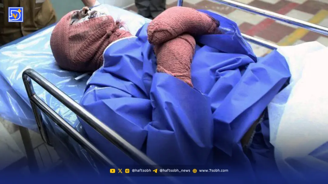 اختلافات دنباله‌دار دو برادر به اسیدپاشی منجر شد
