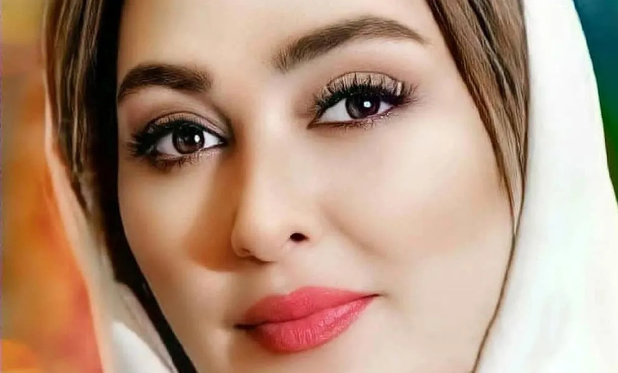 الهام حمیدی و دکتر زیبایی خوش چهره اش + عکس