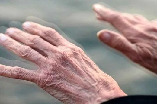 این نشانه‌ها زنگ خطر شروع پارکینسون است