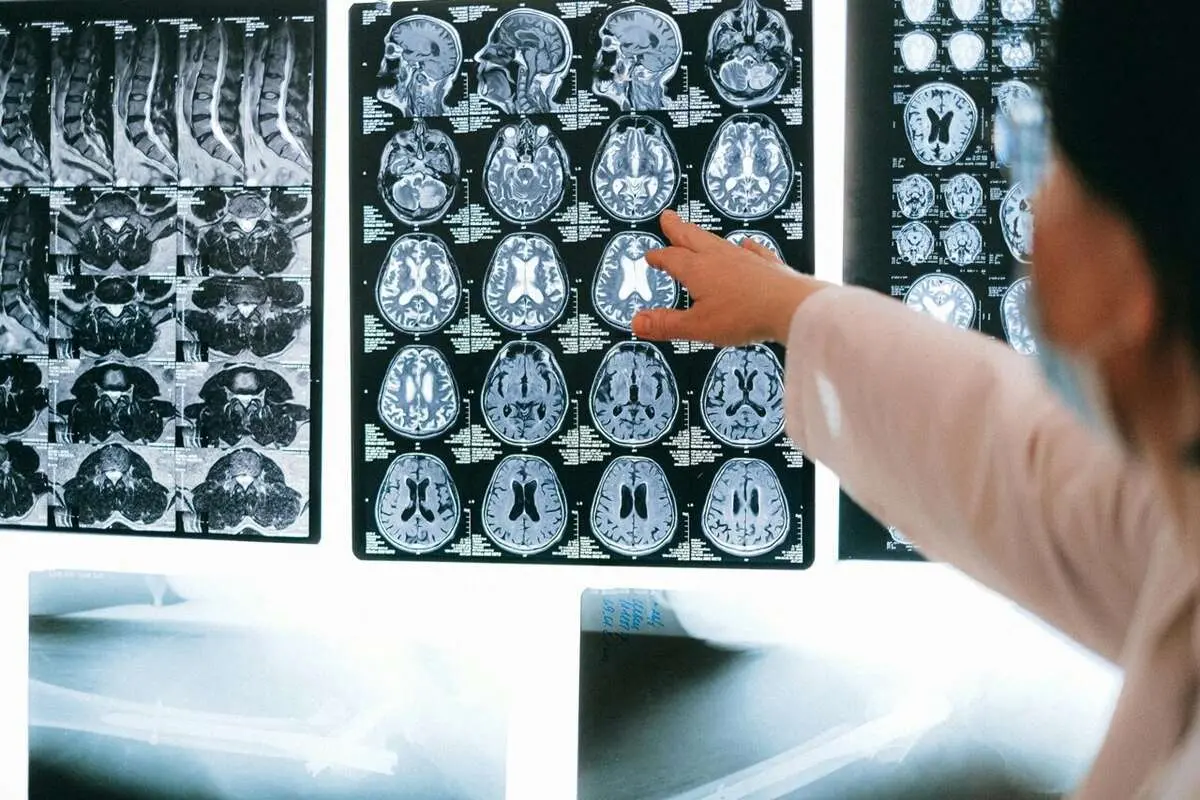پیشگیری از زوال عقل