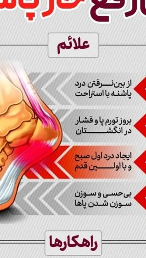 چند توصیه خانگی برای رفع خارپاشنه/ اینفوگرافی