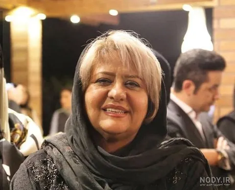 عکس/ تغییر چهره رابعه اسکویی بعد از عمل زیبایی!