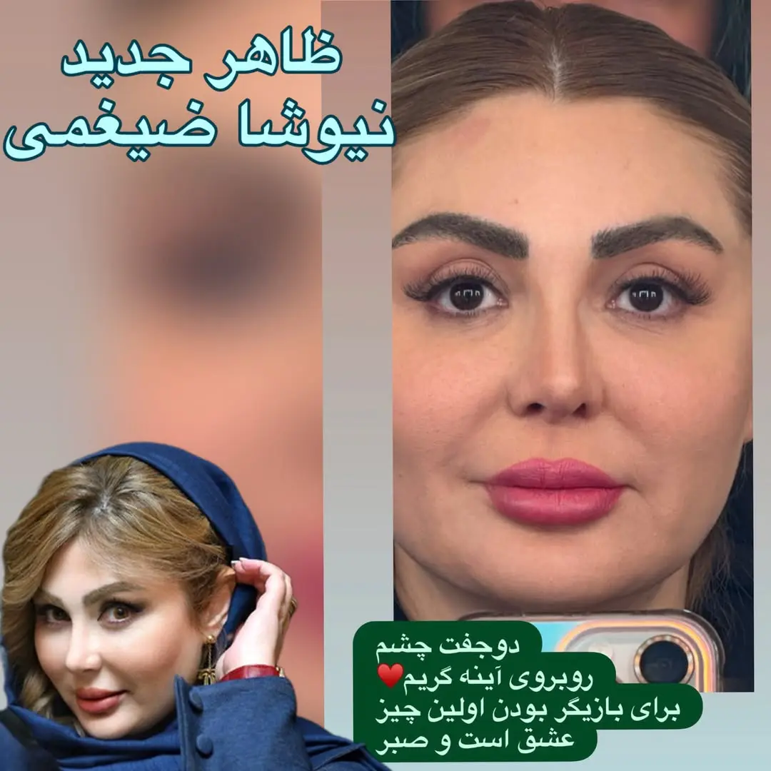 نیوشا ضیغمی