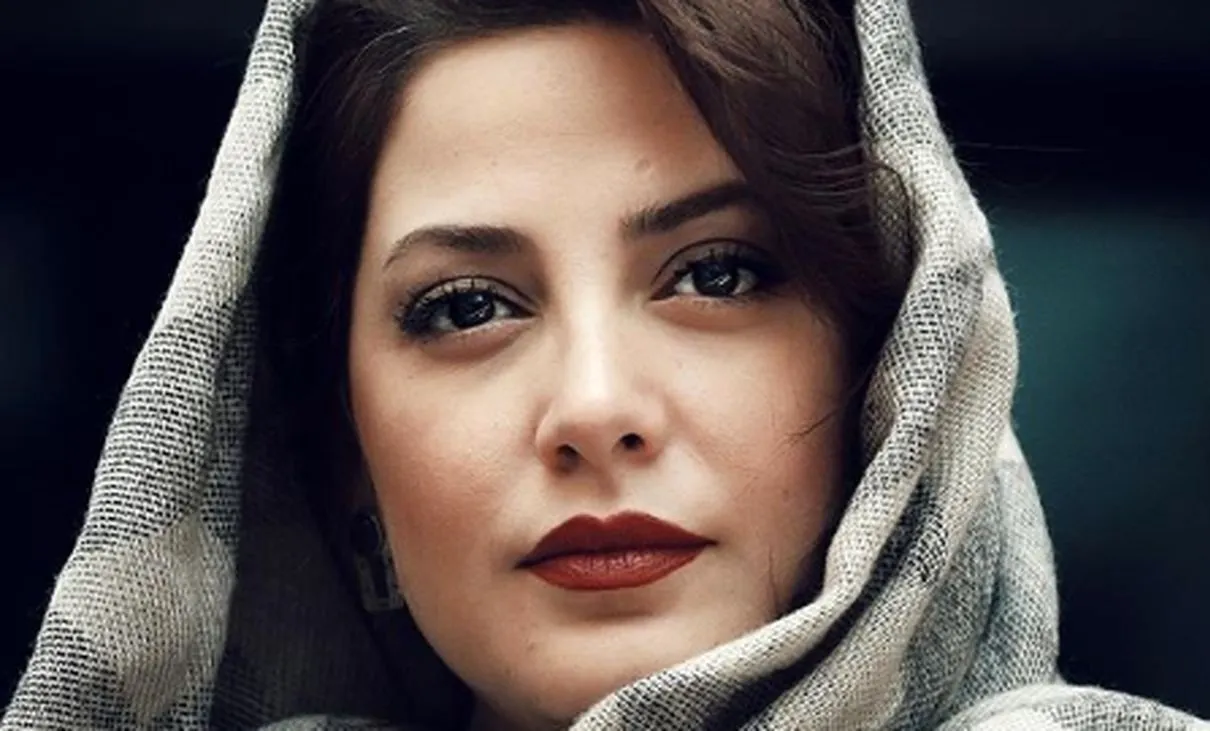 طناز طباطبایی قبل از عمل زیبایی + عکس