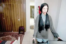 چه کار کردی که این بلا سرت آمد؟؛ زخم‌های ناتمام قربانیان اسیدپاشی از جراحی تا خانه‌نشینی