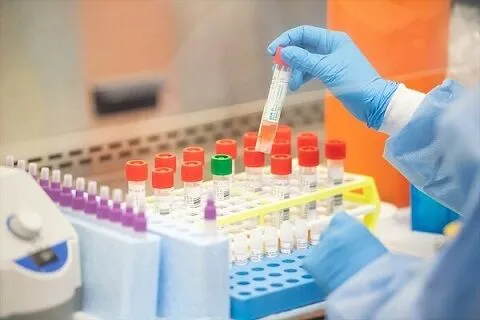 وزارت بهداشت: کیت ایرانی آزمایش تشخیصی سریع کرونا ساخته شد