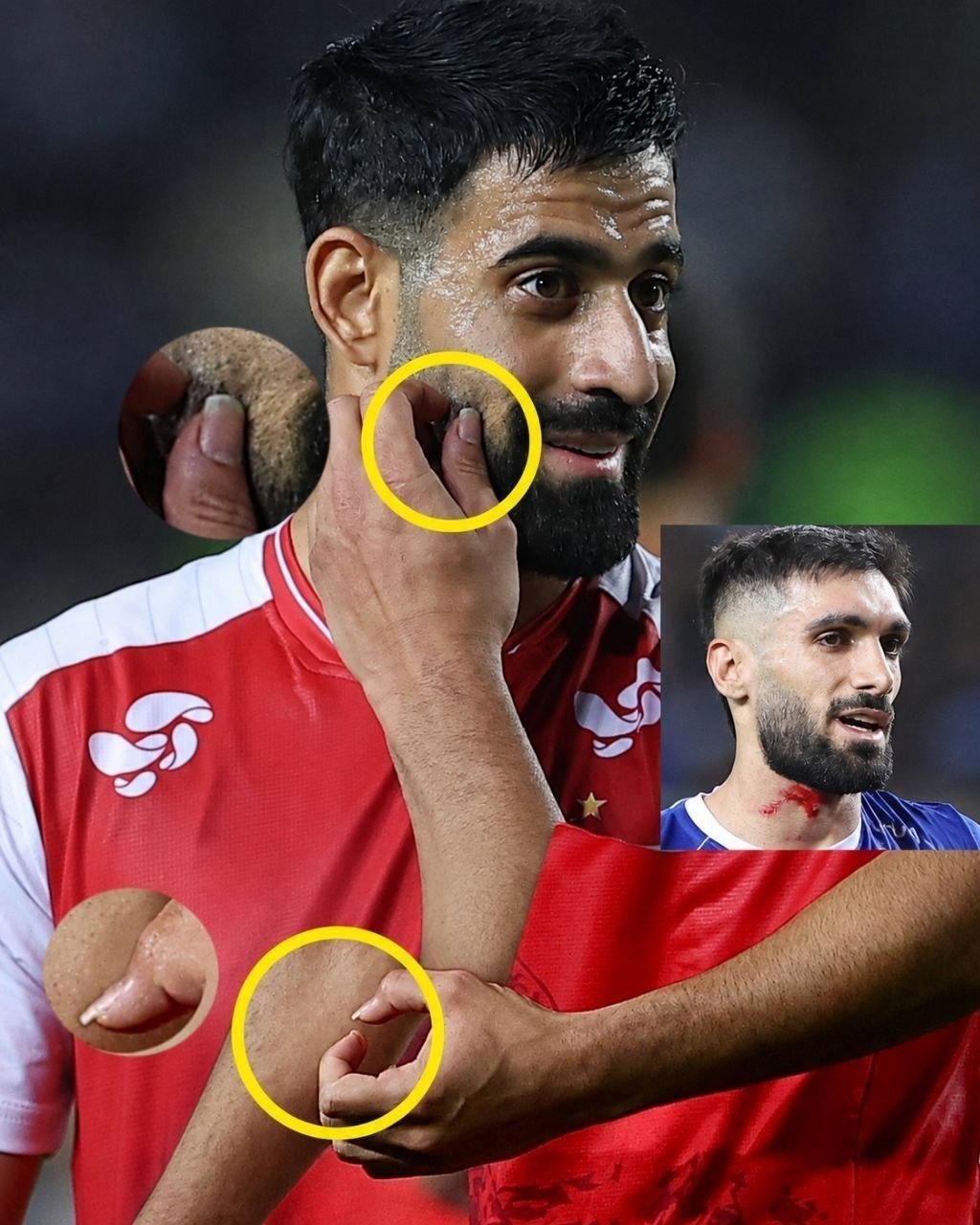 ناخن‌های حسین کنعانی‌زادگان