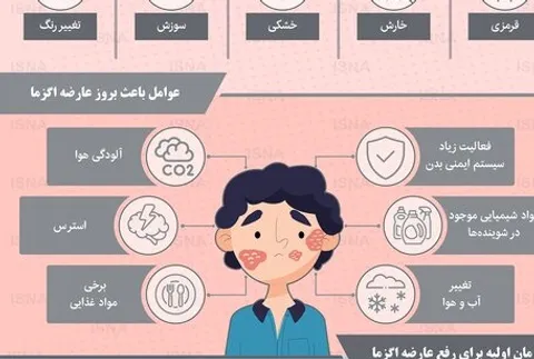 چطور عارضه اگزمای صورت را شناسایی کنیم؟ / اینفوگرافی