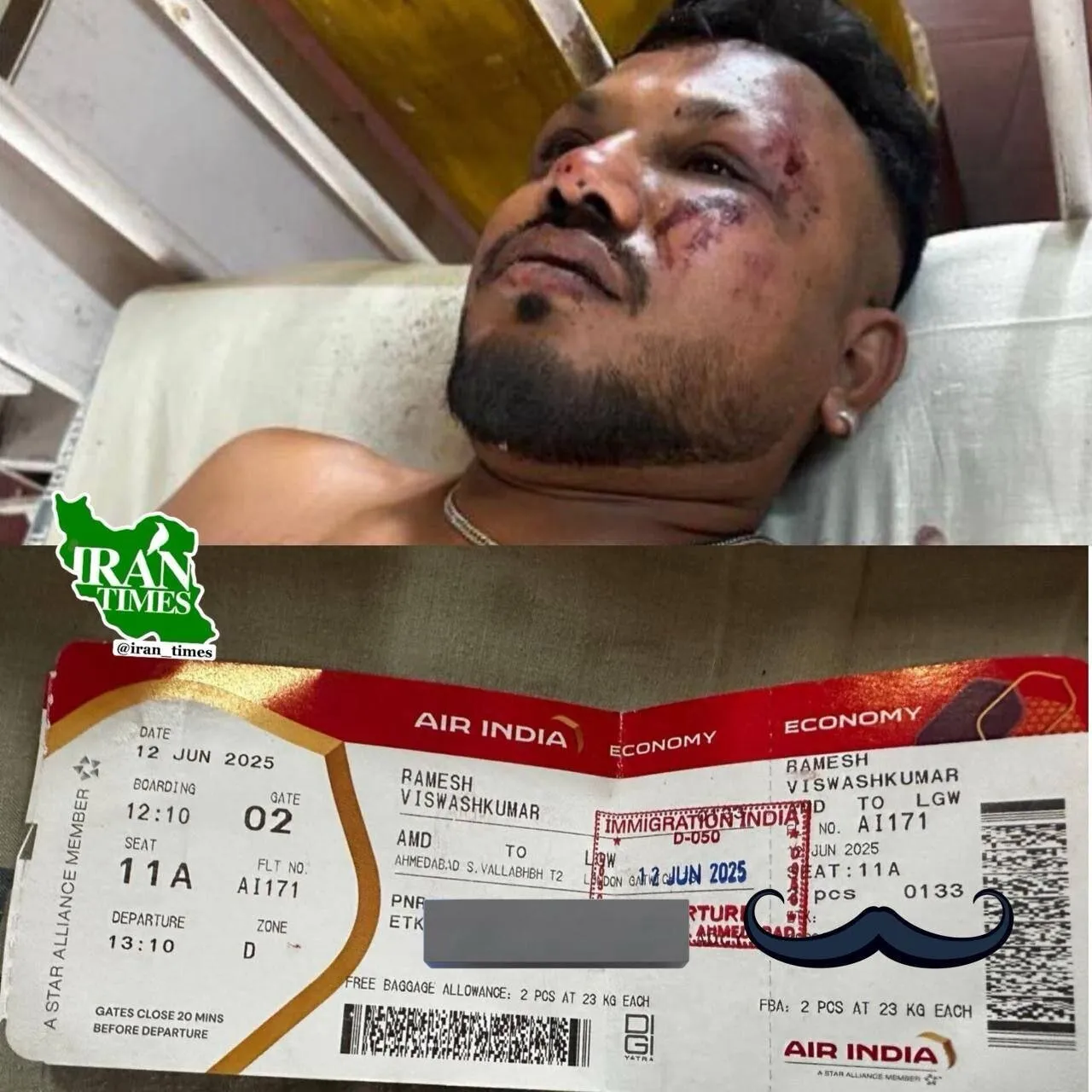 عکس/تنها بازمانده سقوط هواپیما در هند
