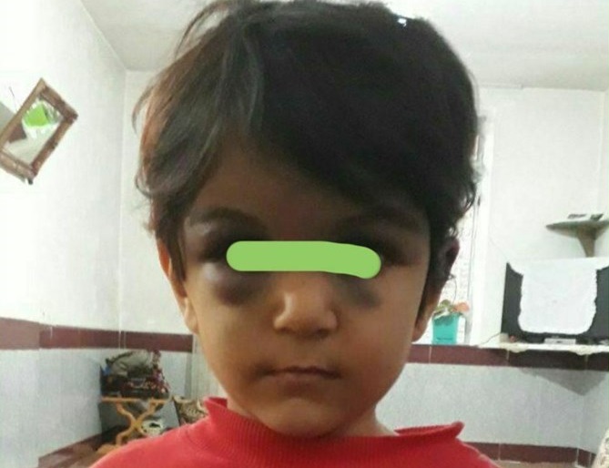 کودک‌آزاری
